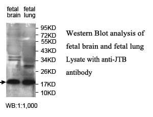 Polyclonal Rabbit anti-Human JTB / PAR Antibody (aa16-99, IHC, WB)