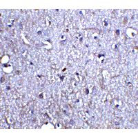NRTN / Neurturin Antibody