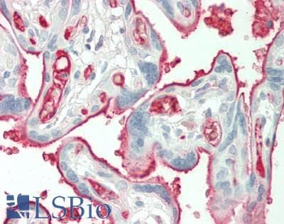 IHC-plus™ A2M / Alpha-2-Macroglobulin Antibody