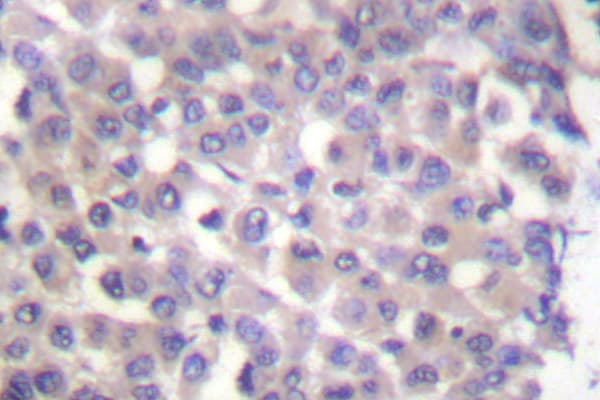KRT18 / CK18 / Cytokeratin 18 Antibody (Pro27)
