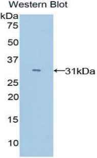 Polyclonal Rabbit anti-Mouse MYO1E / Myosin IE Antibody (aa772-1033, WB)