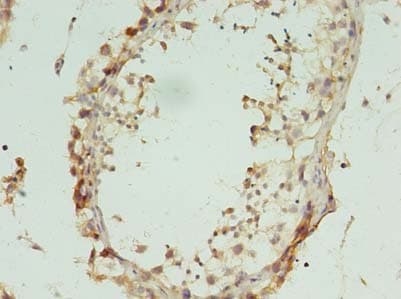 Polyclonal Rabbit anti-Human L2HGDH Antibody (IHC, WB)