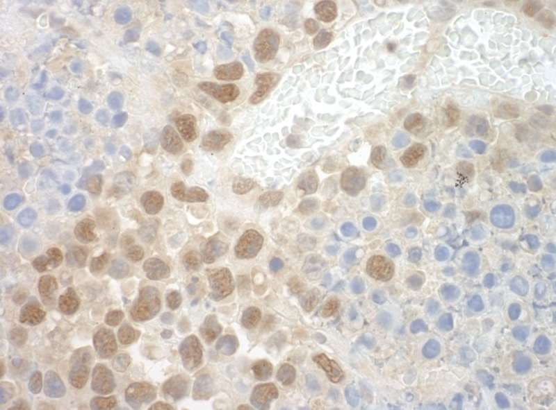 Polyclonal Rabbit anti-Human POGZ Antibody (aa1360-1410, IHC)