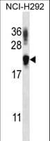 Polyclonal Rabbit anti-Human TTC33 Antibody (aa1-30, WB)