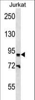 ZNF780B Antibody (aa104-133)