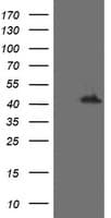 MAP2K1 / MKK1 / MEK1 Antibody (clone OTI1E5)