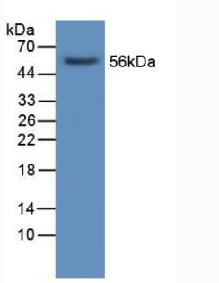 LIPC / Hepatic Lipase Antibody (aa25-247)