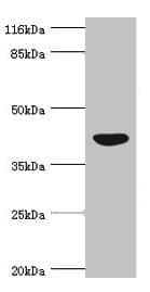 Polyclonal Rabbit anti-Human NDRG2 Antibody (IHC, WB)