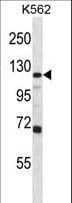 GRIA4 / GLUR4 Antibody (aa296-325)