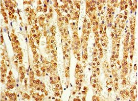 ACVR1C / ALK7 Antibody (aa22-113)
