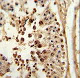 Polyclonal Rabbit anti-Human PPP3R2 Antibody (aa3-29, IHC, WB)