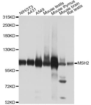 Polyclonal Rabbit anti-Human MSH2 Antibody (IHC, IF, WB)