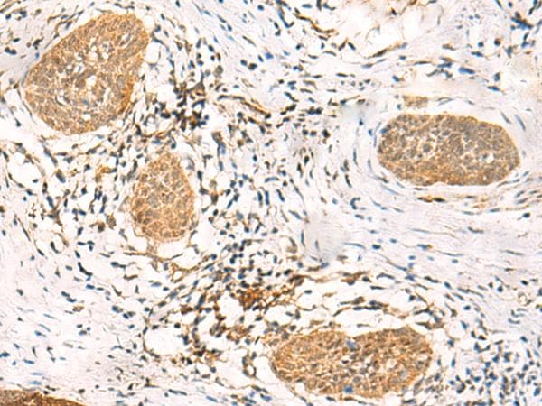 FAT10 / UBD Antibody