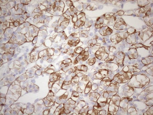 KRT18 / CK18 / Cytokeratin 18 Antibody (aa69-372, clone OTI3D1)