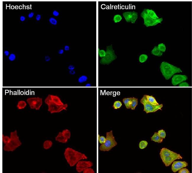 Monoclonal Mouse anti-Human CALR / Calreticulin Antibody (clone 1G6A7, EEEDVPGQAKDELC, IHC, IF, WB)