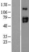 Human ENTPD3 Protein (Over-Expression Lysate Myc-DDK (Flag))