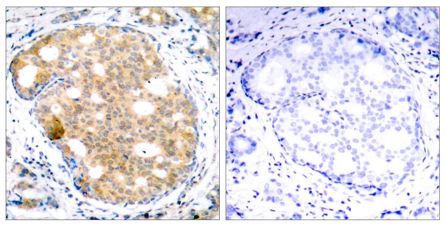 GSK3B / GSK3 Beta Antibody (p9)