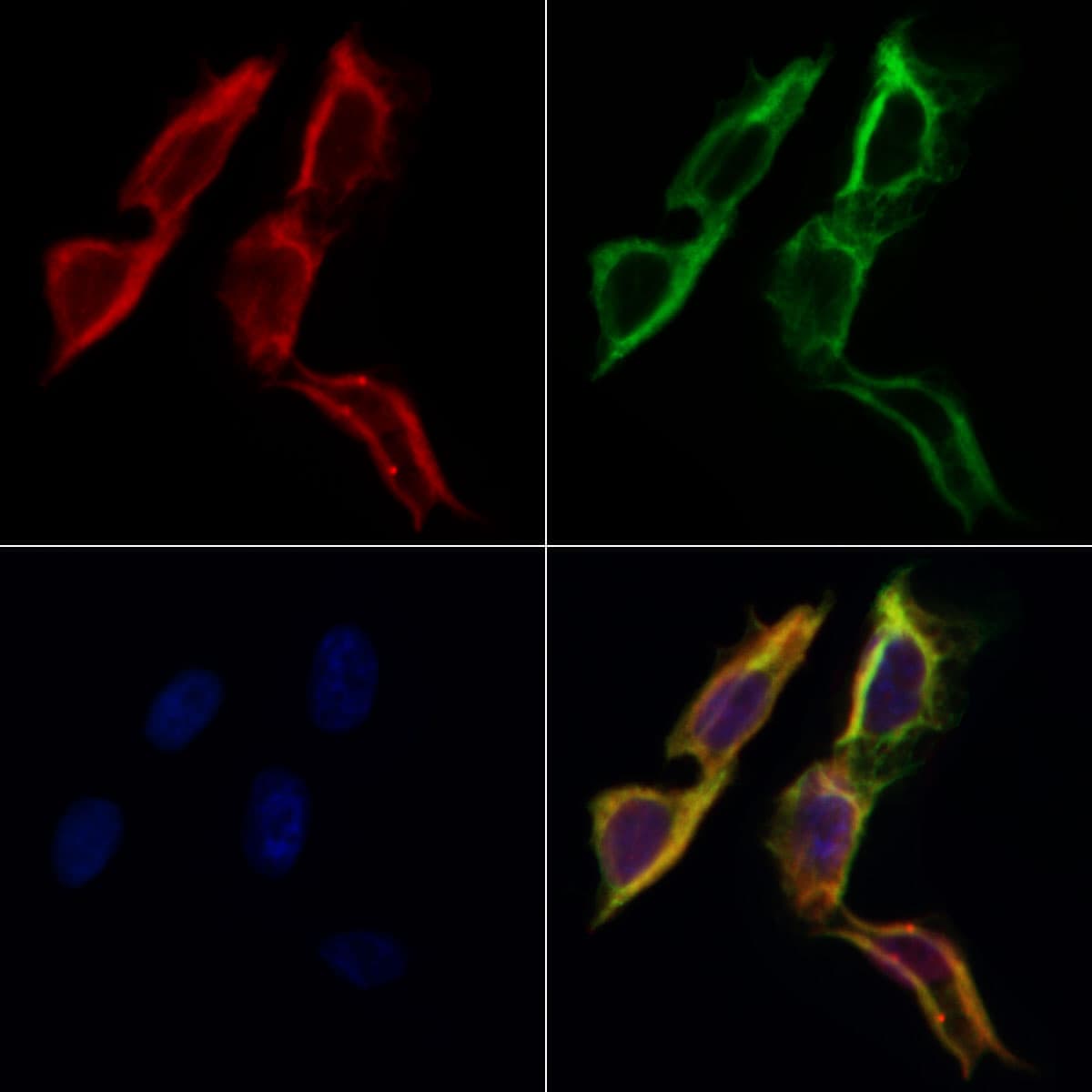 FAM134B Antibody