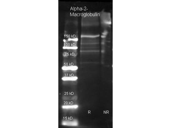 A2M / Alpha-2-Macroglobulin Antibody (Lyophilized)
