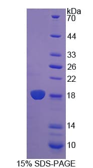 Rat Reg3b Protein (Recombinant His)