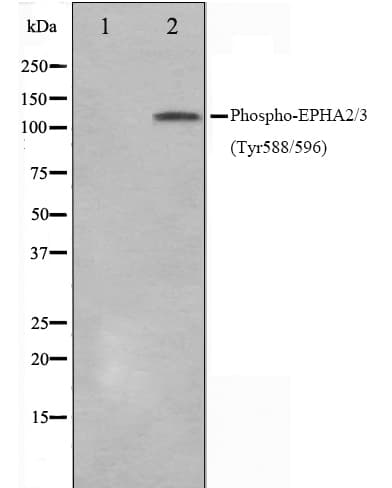 Polyclonal Rabbit anti-Human EPHA2 / EPH Receptor A2 Antibody (phospho-Tyr588,phospho-Tyr596, IF, WB)