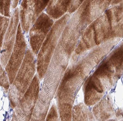 Polyclonal Rabbit anti-Human COX17 Antibody (IHC, IF, WB)