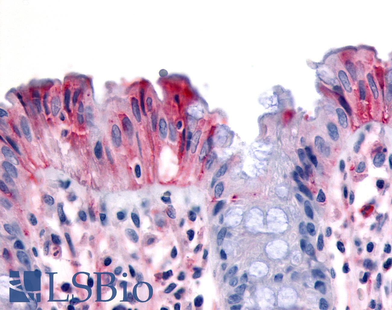 IHC-plus™ MST1R / RON Antibody (Internal)