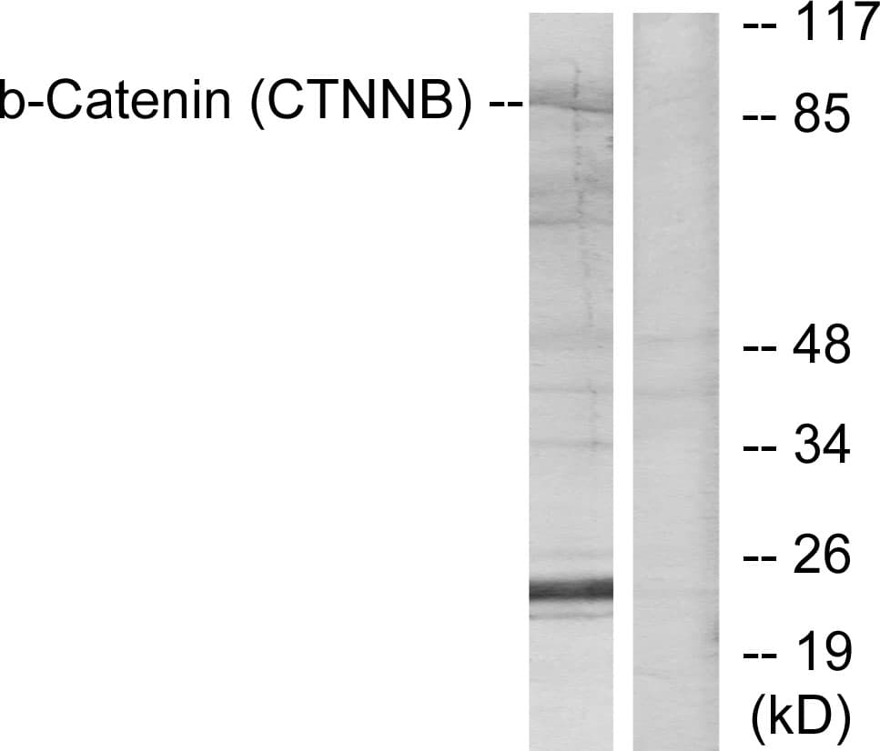 Polyclonal Rabbit anti-Human CTNNB1 / Beta Catenin Antibody (aa11-60, WB)