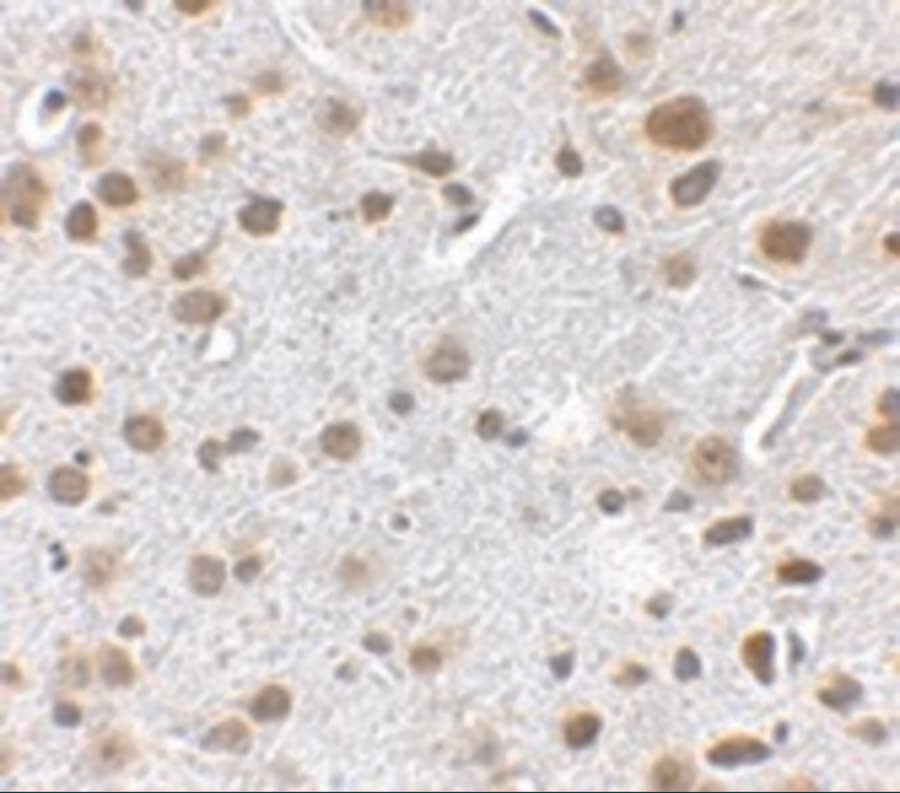 FTO Antibody