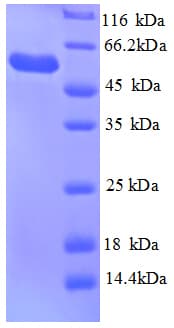 E. coli Glycerol Kinase Protein (Recombinant His)