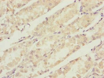 CBR4 Antibody