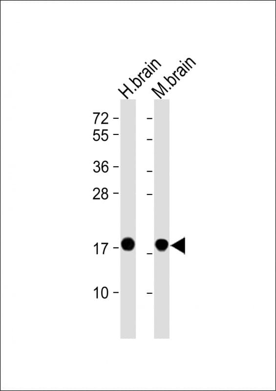 Monoclonal Mouse anti-Human SNCA / Alpha-Synuclein Antibody (clone 1853CT506.24.16, WB)