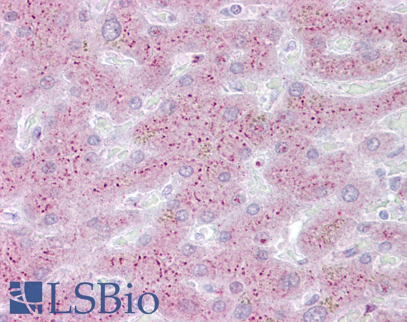 PROS1 / Protein S Antibody (aa251-300)