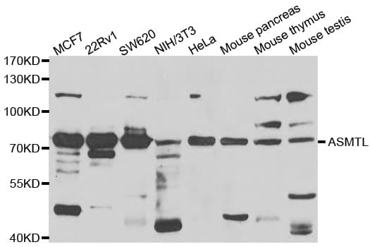 Polyclonal Rabbit anti-Human ASMTL Antibody (IHC, WB)