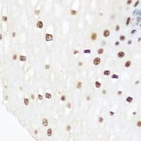 INTS5 Antibody