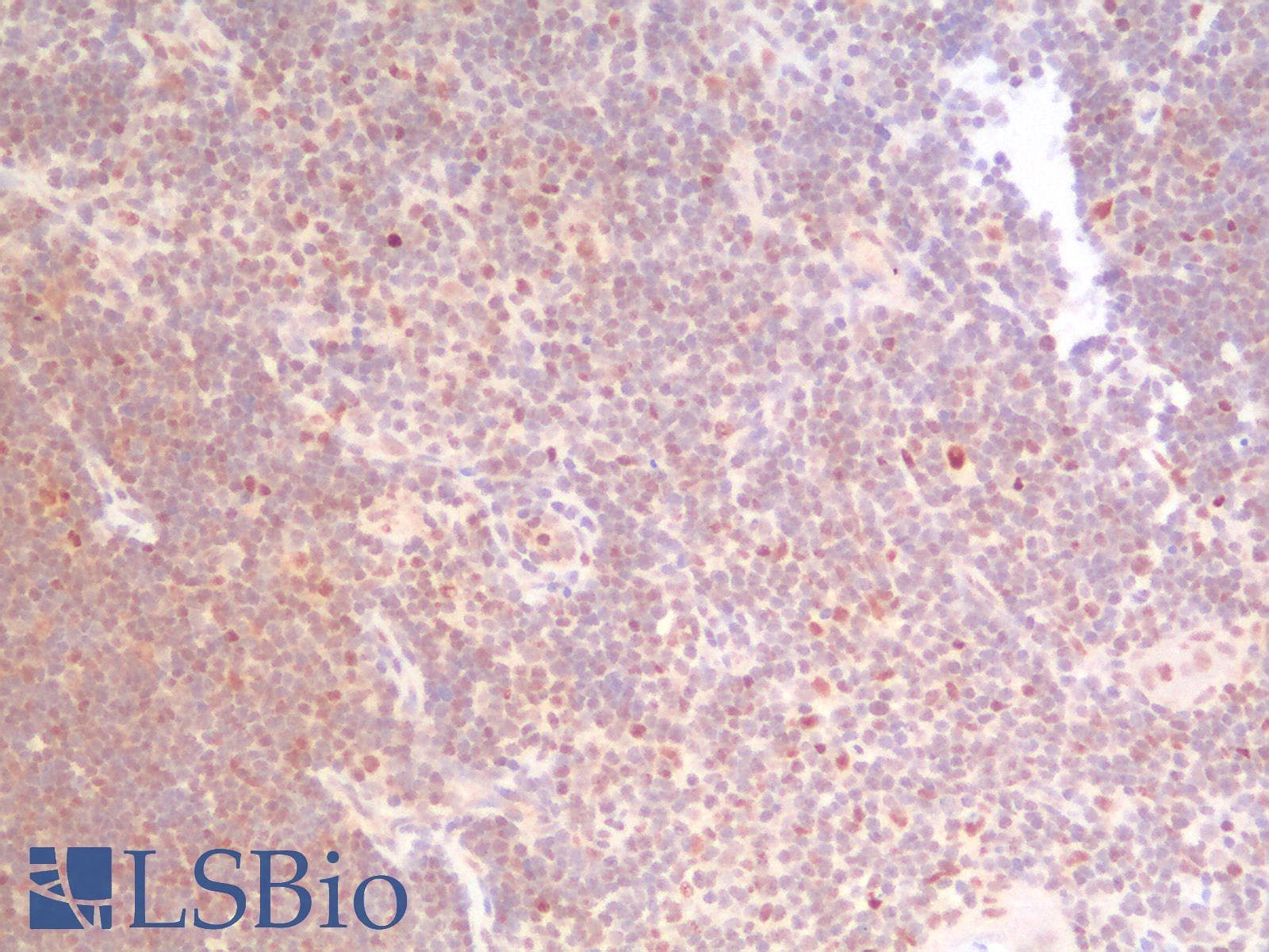 PathPlus™ TP53 / p53 Antibody (clone rBP53-12)