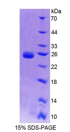 Rat BCAT2 Protein (Recombinant His-T7, N-terminus)