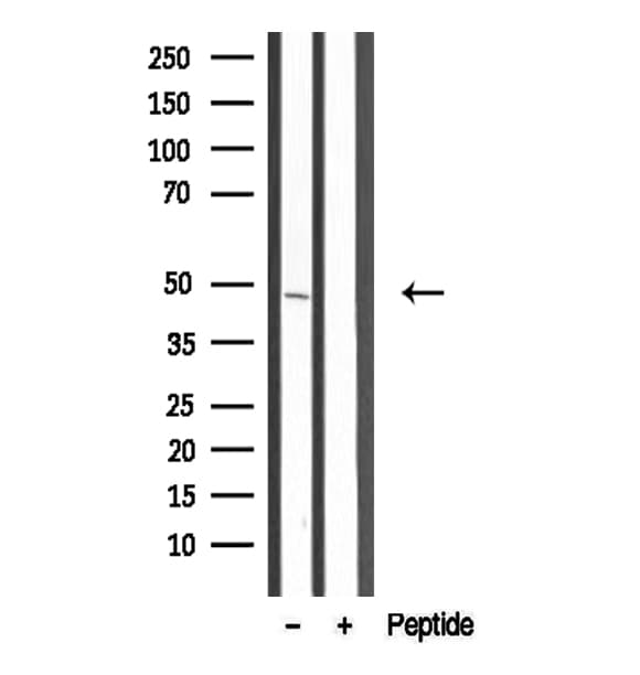 Polyclonal Rabbit anti-Human CD63 Antibody (IHC, WB)