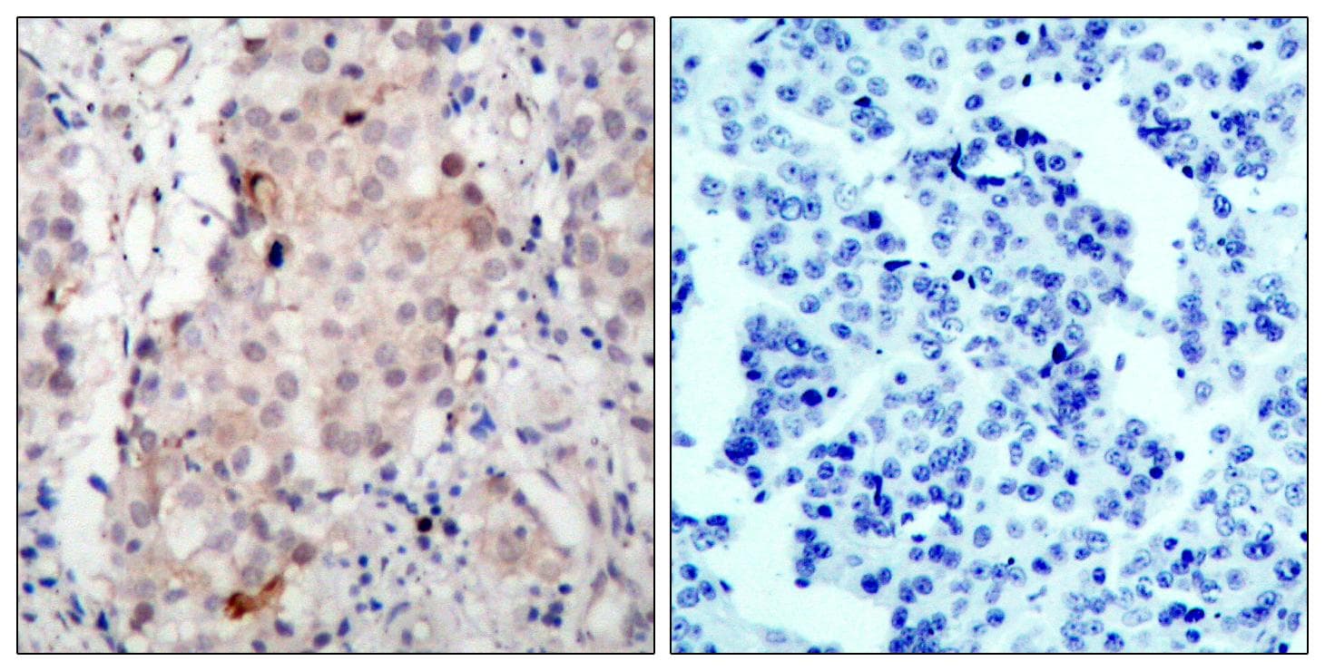 ERBB2 / HER2 Antibody