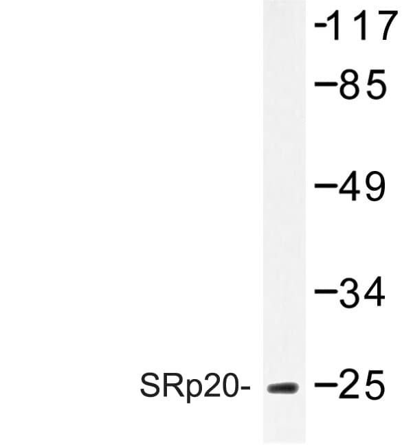 IHC-plus™ SRSF3 / SRP20 Antibody (aa120-170)