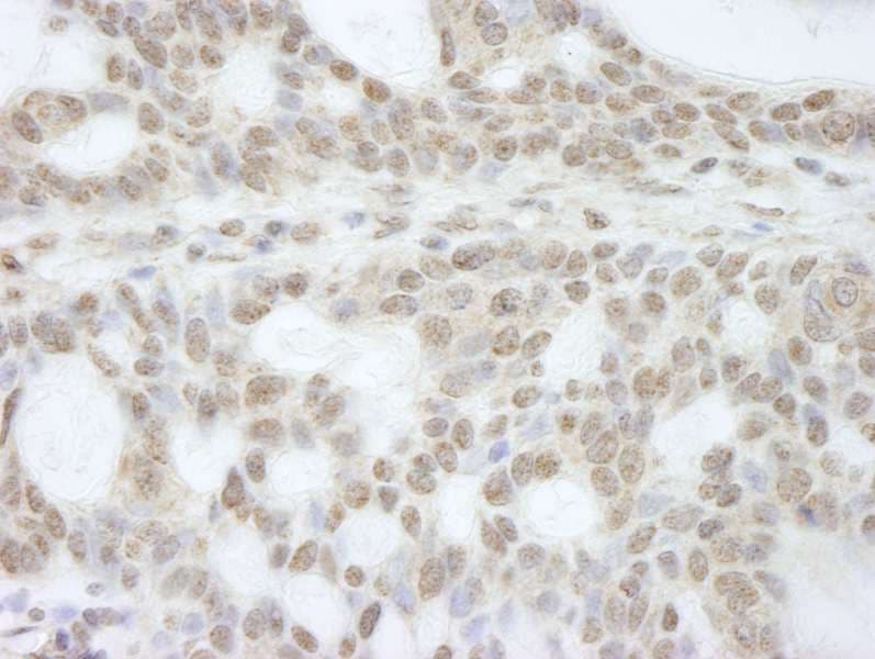 ATRX Antibody (aa2442-C-term)