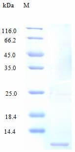 Human CCL14 Protein (Recombinant)
