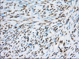 ERIC-1 / TACC3 Antibody (clone OTI6C6)