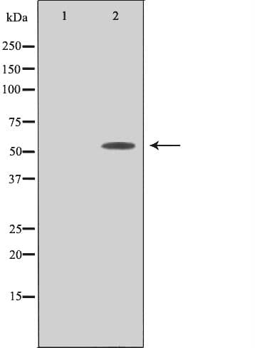 PPHLN1 Antibody