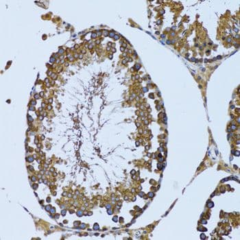 Polyclonal Rabbit anti-Human GCN2 Antibody (IHC, IF, WB)