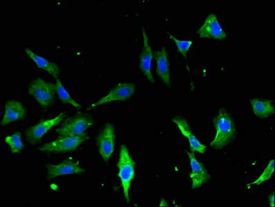 Polyclonal Rabbit anti-Human ANXA2 / Annexin A2 Antibody (aa2-339, IHC, WB)