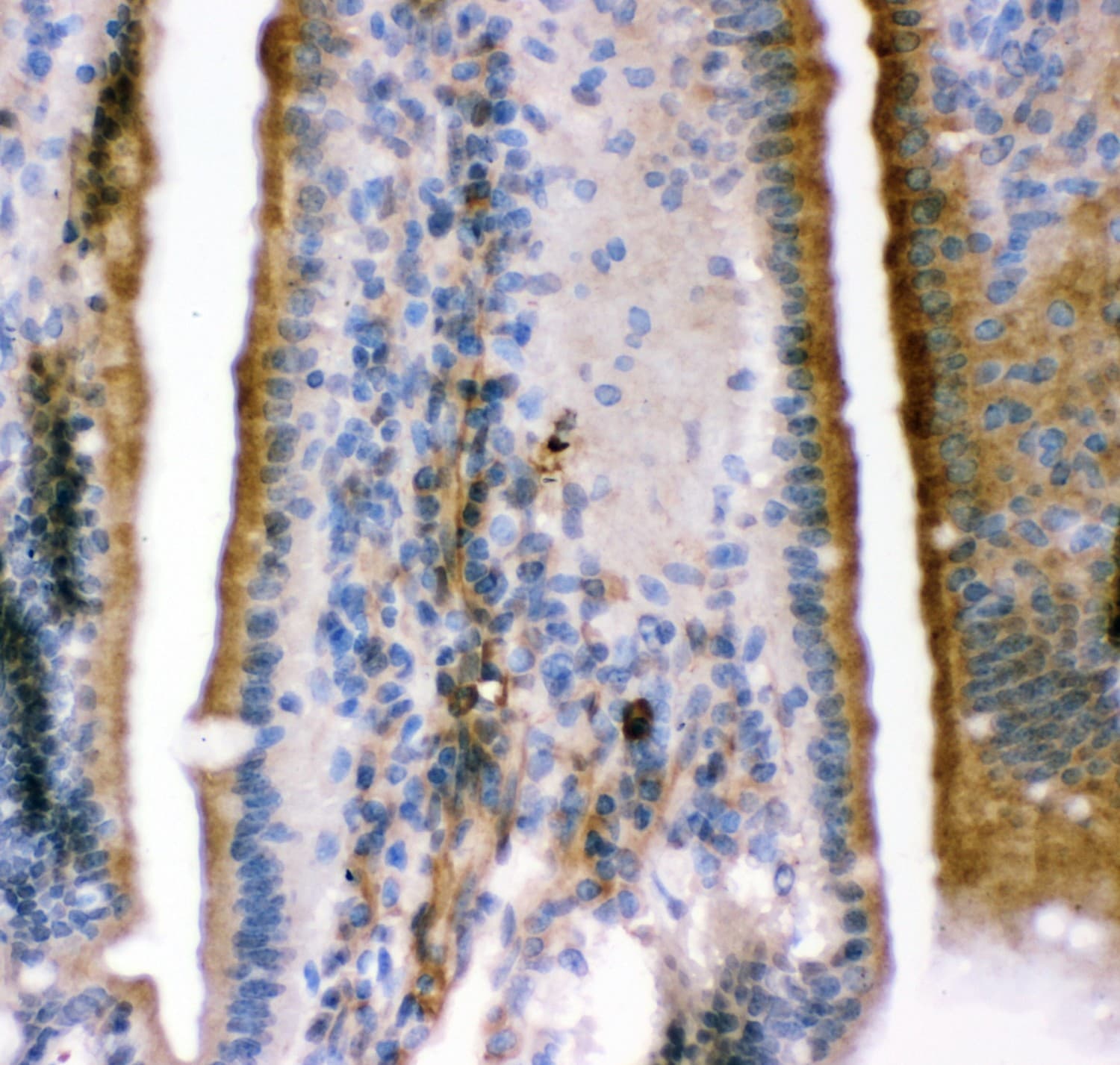 KCNMA1 / BK Antibody (aa124-467)
