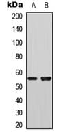 PLK1 / PLK-1 Antibody (Internal)