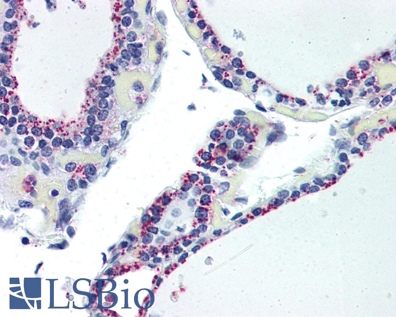 IHC-plus™ ADORA2B/Adenosine A2B Receptor Antibody (Internal)
