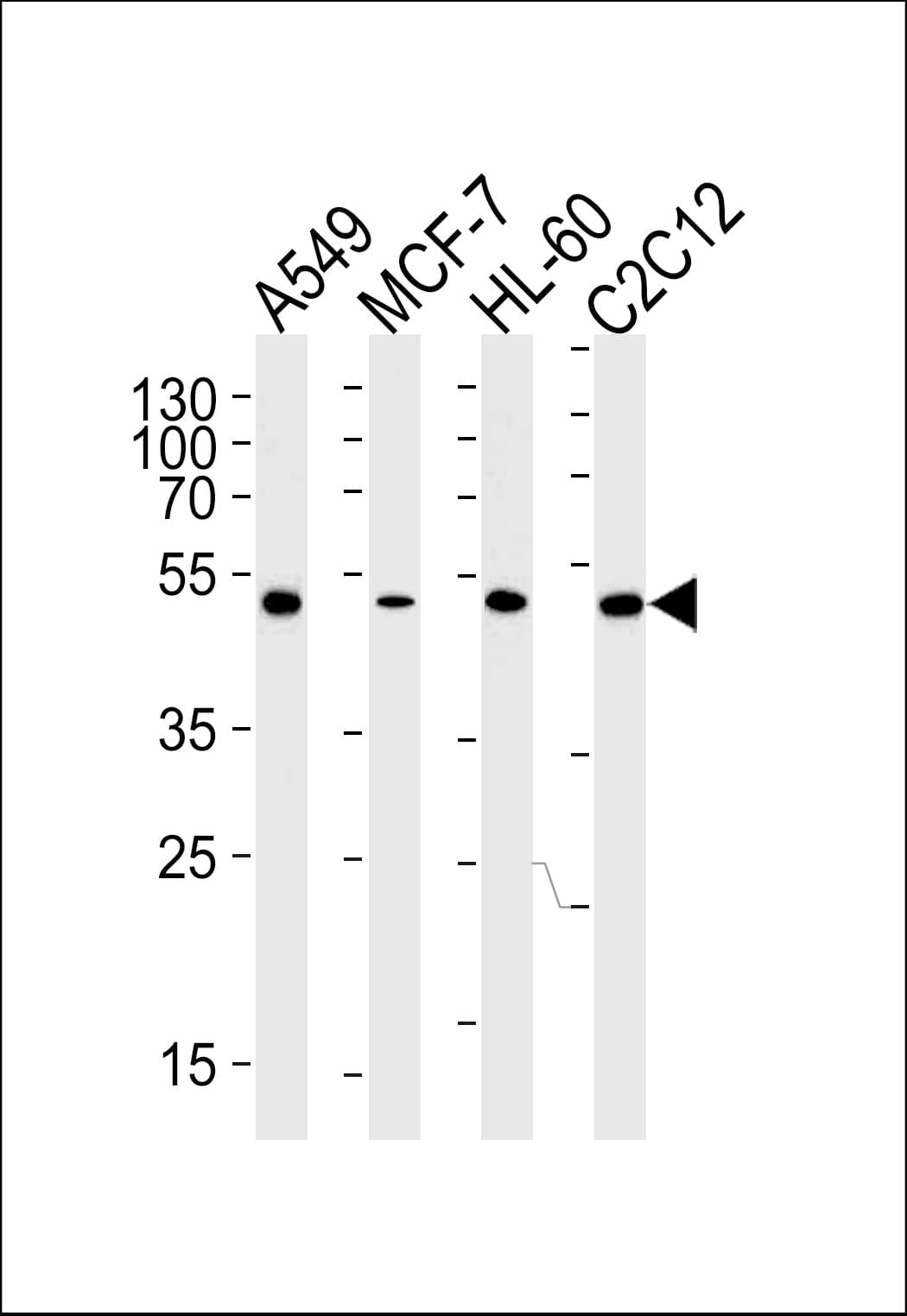 IHC-plus™ AVPR1A / V1a Receptor Antibody (aa353-383, clone 721CT25.2.1)